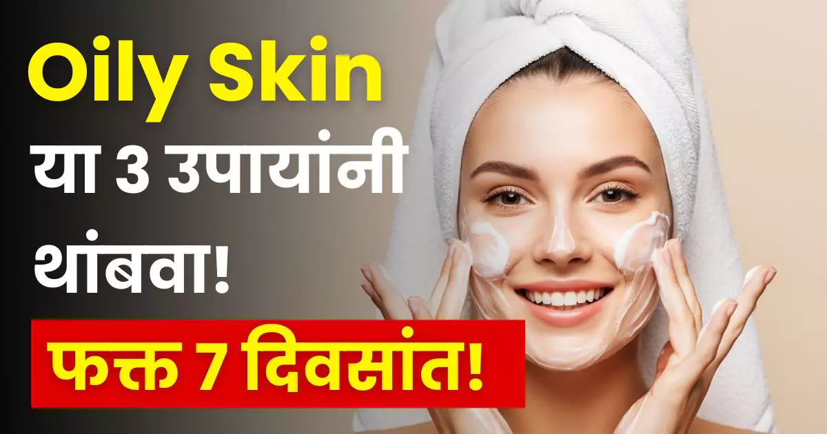 Oily skin care tips