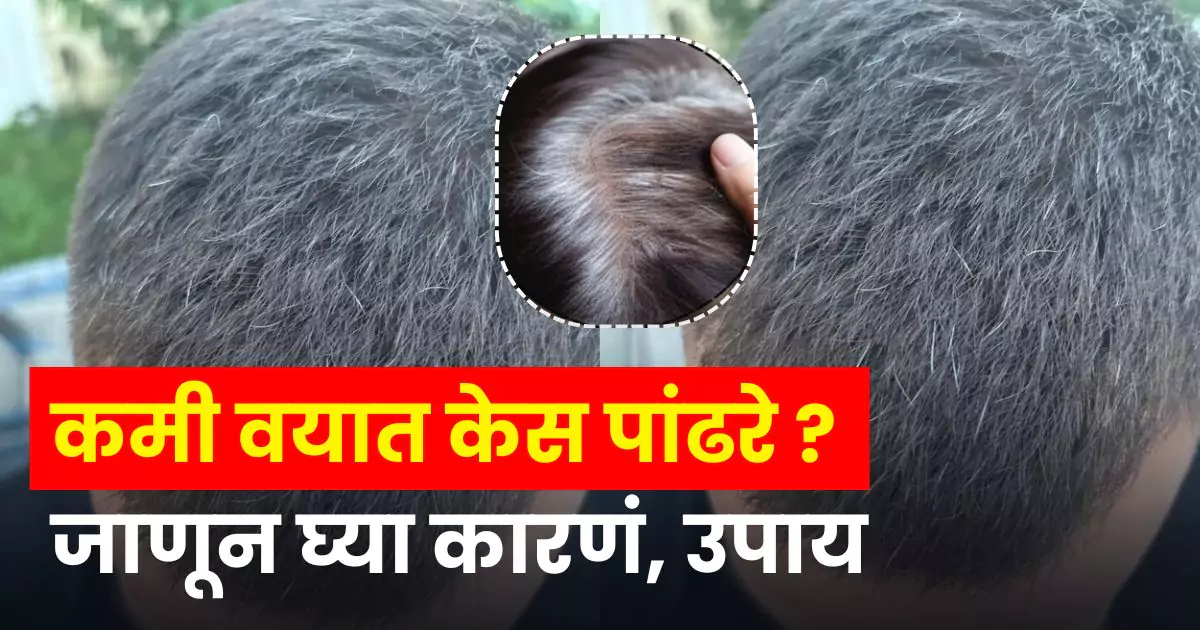 white hair prevention